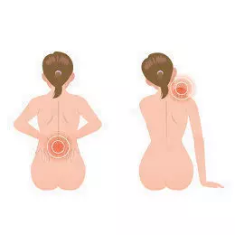 Die typischen Problemzonen beim Rücken Rücken Problemzonen